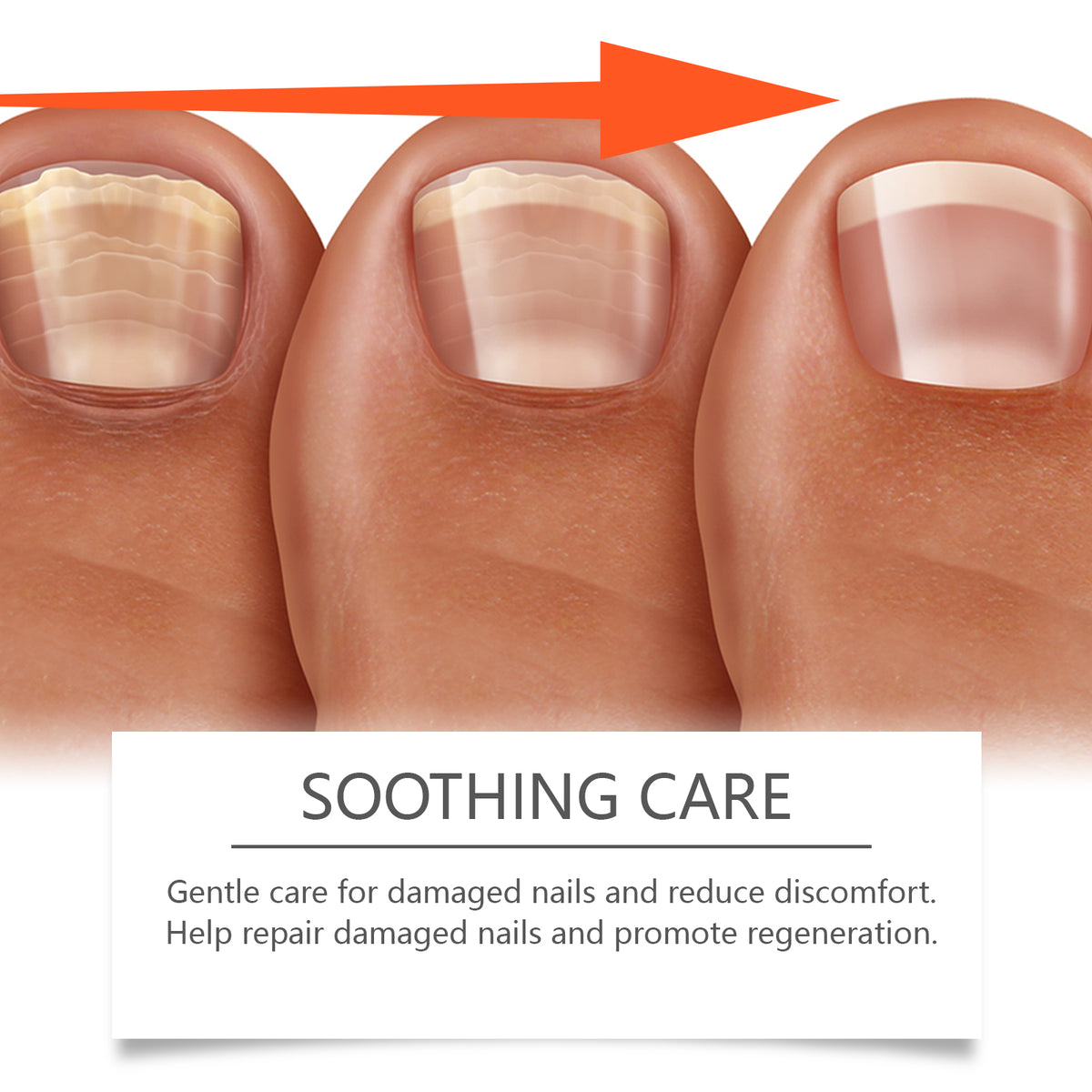 Herbal Nail Care Solution Hand, Foot And Nail Cleansing And Repair Bright Nail Thick Toe Care Solution
