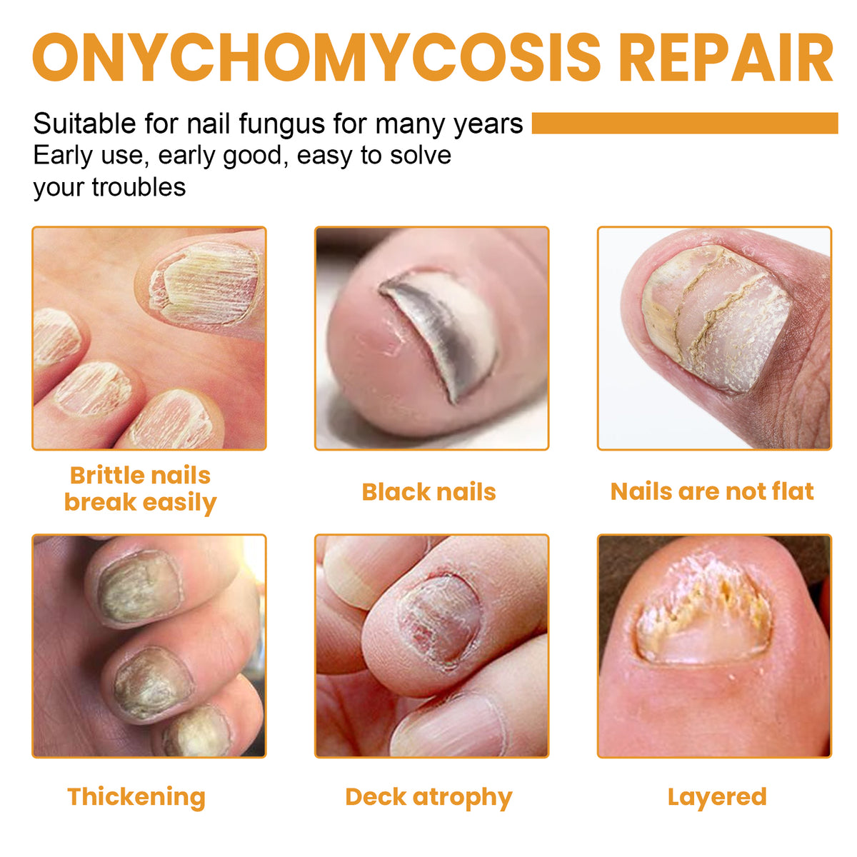 Fungal Nail Patches, Repair Nail Thickening Grey Nail Soft Nail Shine Nail Care Patch